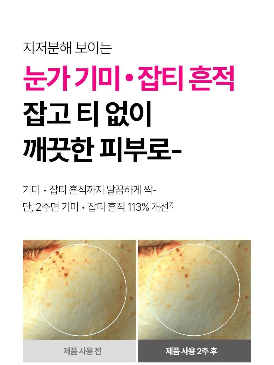 [퀭한눈가패치] 아이소이 블레미쉬 케어 아이&미간 패치 90매 더블 기획 상세페이지 19